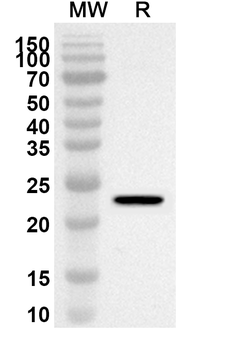 TMOD1 Rabbit Polyclonal Antibody