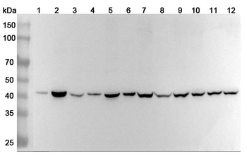 CD172b/SIRPB1 Rabbit Polyclonal Antibody