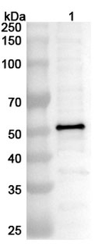 HMPV Matrix protein/M Rabbit Polyclonal Antibody