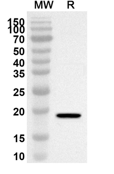 VSIR/VISTA Rabbit Polyclonal Antibody