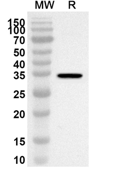 APH1A Rabbit Polyclonal Antibody