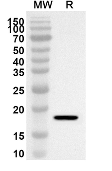 CERS2 Rabbit Polyclonal Antibody