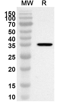 CTPS2 Rabbit Polyclonal Antibody