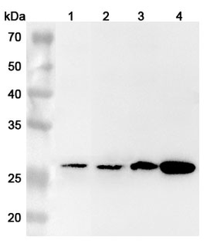 AGR3 Rabbit Polyclonal Antibody