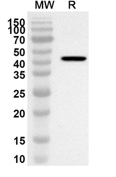 SETD7 Rabbit Polyclonal Antibody