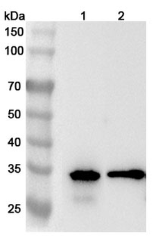 CNN1 Rabbit Polyclonal Antibody
