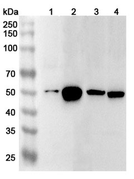 HNRNPH1 Rabbit Polyclonal Antibody
