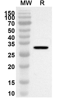 TACR1 Rabbit Polyclonal Antibody