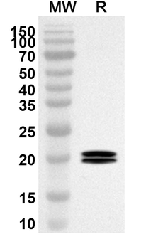 CD88/C5AR1 Rabbit Polyclonal Antibody