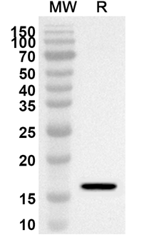 FABP2 Rabbit Polyclonal Antibody
