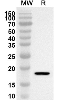 ARPC3 Rabbit Polyclonal Antibody