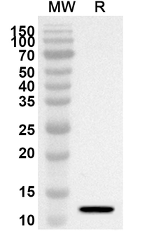 HNRNPA2B1 Rabbit Polyclonal Antibody