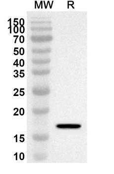 MCEE Rabbit Polyclonal Antibody