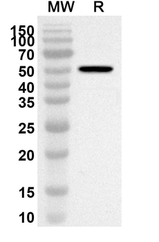 NCF1 Rabbit Polyclonal Antibody