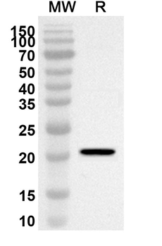 RBM3 Rabbit Polyclonal Antibody