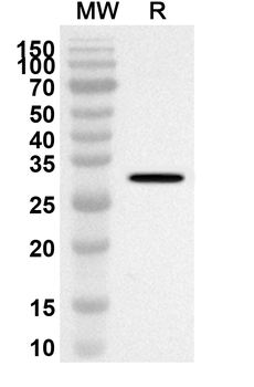 DSG2 Rabbit Polyclonal Antibody