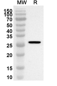 GLI3 Rabbit Polyclonal Antibody