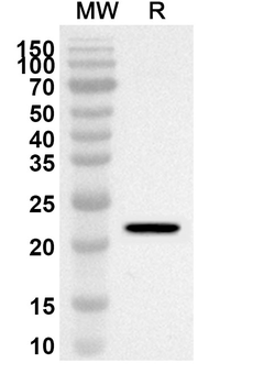 CDH15 Rabbit Polyclonal Antibody
