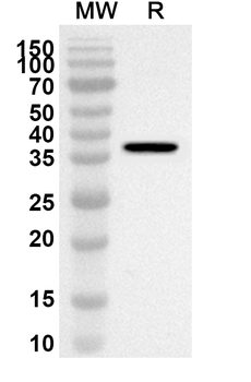 DNM3 Rabbit Polyclonal Antibody