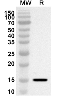 CHRNB3 Rabbit Polyclonal Antibody