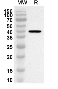 ADSL Rabbit Polyclonal Antibody