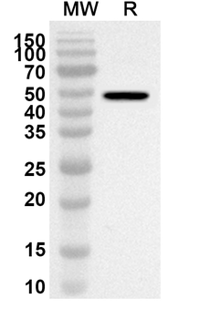 MTA2 Rabbit Polyclonal Antibody