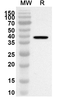 GPLD1 Rabbit Polyclonal Antibody