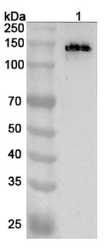 ABCC8 Rabbit Polyclonal Antibody