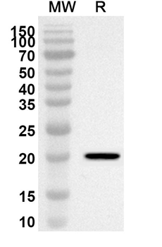 TNIP2 Rabbit Polyclonal Antibody