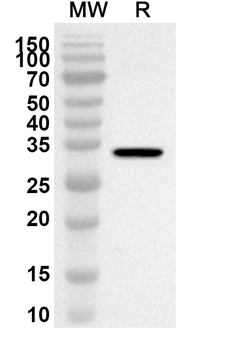 TWF1 Rabbit Polyclonal Antibody