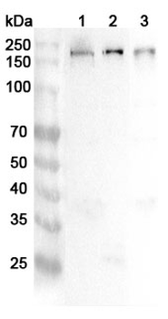 TJP2 Rabbit Polyclonal Antibody