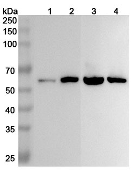 ALDH7A1 Rabbit Polyclonal Antibody