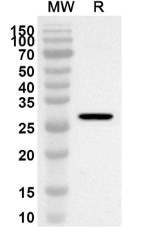 ACADL Rabbit Polyclonal Antibody