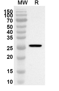 CEMIP Rabbit Polyclonal Antibody