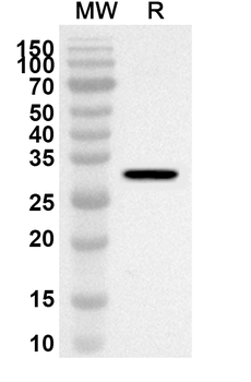 DPYD Rabbit Polyclonal Antibody