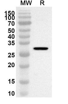DAG1/Dystroglycan Rabbit Polyclonal Antibody