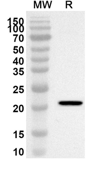 MRPL11 Rabbit Polyclonal Antibody