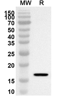 ZBTB18 Rabbit Polyclonal Antibody