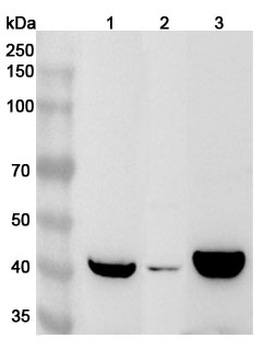 ABHD2 Rabbit Polyclonal Antibody