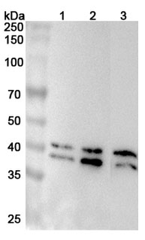 SET Rabbit Polyclonal Antibody