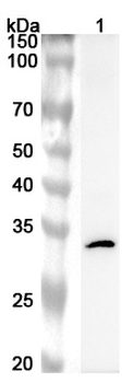 PRKRA Rabbit Polyclonal Antibody