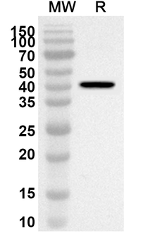 KIF2A Rabbit Polyclonal Antibody