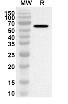 IFIT5 Rabbit Polyclonal Antibody