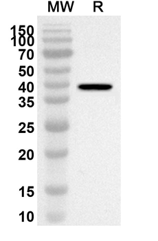 CDK12 Rabbit Polyclonal Antibody