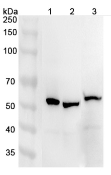 ATP6V1B1 Rabbit Polyclonal Antibody