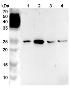 LYPLA1 Rabbit Polyclonal Antibody
