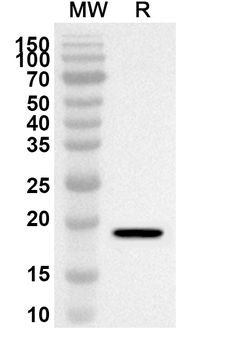 SETBP1 Rabbit Polyclonal Antibody