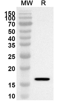 EIF2S2 Rabbit Polyclonal Antibody