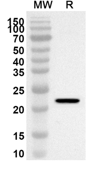 SATB2 Rabbit Polyclonal Antibody