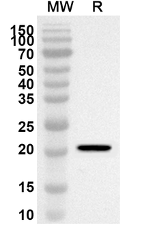 RPL7A Rabbit Polyclonal Antibody